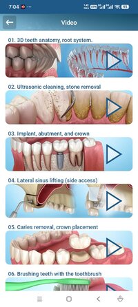 Screenshot_2026-08-16-07-04-33-980_com.alexmit.dentalillustrations.jpg