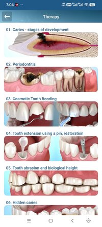 Screenshot_2026-08-16-07-04-13-965_com.alexmit.dentalillustrations.jpg