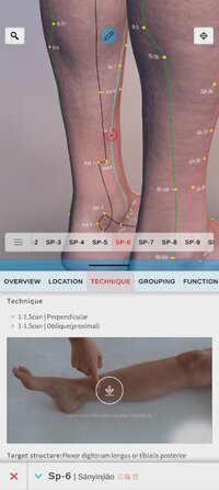 Screenshot_2026-09-28-16-15-46-659_com.graphicvizion.acuatlas3d.jpg