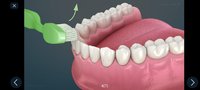 Screenshot_2023-10-30-21-56-55-947_com.alexmit.dentalillustrations.jpg