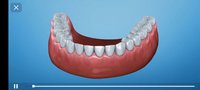 Screenshot_2023-10-30-21-57-08-293_com.alexmit.dentalillustrations.jpg