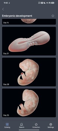 Screenshot_2026-05-30-09-43-17-303_com.innowise.pathology3d.jpg